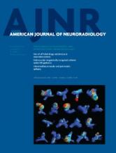 American Journal of Neuroradiology: 34 (11)