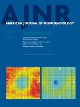 American Journal of Neuroradiology: 34 (12)