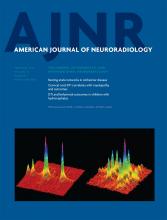 American Journal of Neuroradiology: 34 (2)