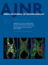 American Journal of Neuroradiology: 34 (3)