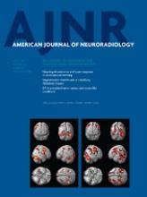 American Journal of Neuroradiology: 34 (4)