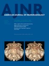 American Journal of Neuroradiology: 34 (5)
