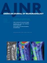 American Journal of Neuroradiology: 34 (6)