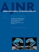 American Journal of Neuroradiology: 34 (7)
