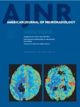 American Journal of Neuroradiology: 34 (8)