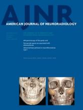 American Journal of Neuroradiology: 34 (9)