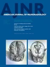 American Journal of Neuroradiology: 35 (1)