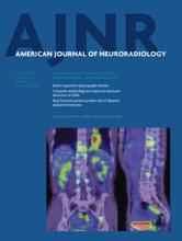 American Journal of Neuroradiology: 35 (10)