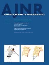 American Journal of Neuroradiology: 35 (2)