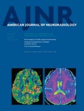 American Journal of Neuroradiology: 35 (3)