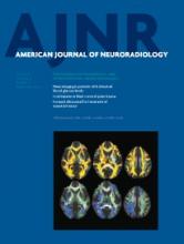 American Journal of Neuroradiology: 35 (5)