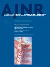 American Journal of Neuroradiology: 35 (6)