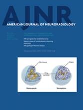 American Journal of Neuroradiology: 35 (7)
