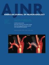 American Journal of Neuroradiology: 35 (8)