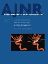 American Journal of Neuroradiology: 35 (9)