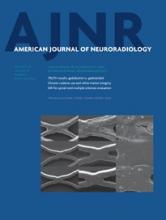 American Journal of Neuroradiology: 36 (1)