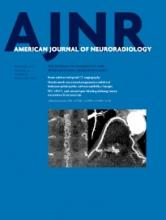 American Journal of Neuroradiology: 36 (12)