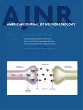 American Journal of Neuroradiology: 36 (2)