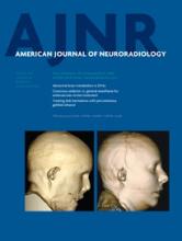 American Journal of Neuroradiology: 36 (3)