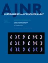 American Journal of Neuroradiology: 36 (4)