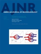 American Journal of Neuroradiology: 36 (5)