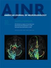 American Journal of Neuroradiology: 36 (6)