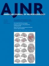 American Journal of Neuroradiology: 36 (7)