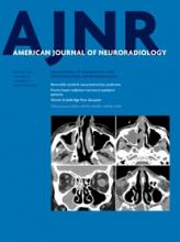 American Journal of Neuroradiology: 36 (8)