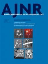 American Journal of Neuroradiology: 37 (1)