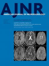 American Journal of Neuroradiology: 37 (10)