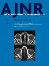 American Journal of Neuroradiology: 37 (12)
