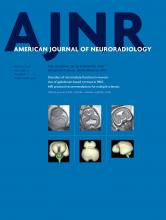 American Journal of Neuroradiology: 37 (3)