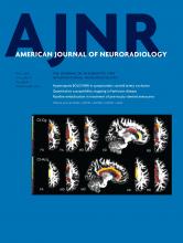 American Journal of Neuroradiology: 37 (5)