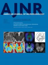 American Journal of Neuroradiology: 37 (6)