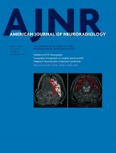 American Journal of Neuroradiology: 37 (8)