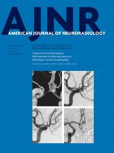 American Journal of Neuroradiology: 37 (9)