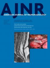 American Journal of Neuroradiology: 38 (1)