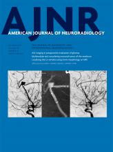 American Journal of Neuroradiology: 38 (10)