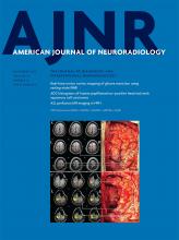American Journal of Neuroradiology: 38 (11)
