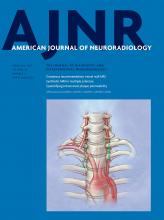 American Journal of Neuroradiology: 38 (2)