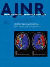 American Journal of Neuroradiology: 38 (3)