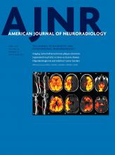 American Journal of Neuroradiology: 38 (4)