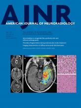 American Journal of Neuroradiology: 38 (5)