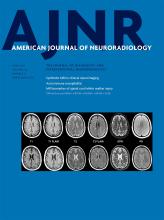 American Journal of Neuroradiology: 38 (6)