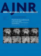 American Journal of Neuroradiology: 38 (8)