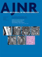 American Journal of Neuroradiology: 39 (1)