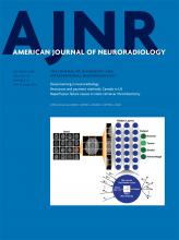 American Journal of Neuroradiology: 39 (10)
