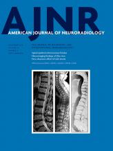 American Journal of Neuroradiology: 39 (11)