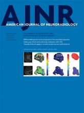 American Journal of Neuroradiology: 39 (12)