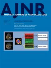 American Journal of Neuroradiology: 39 (2)